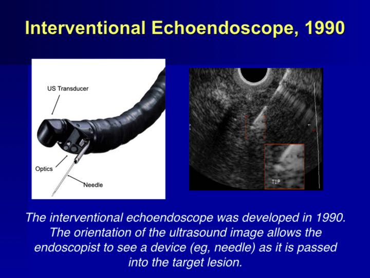 History of Endoscopy endovision