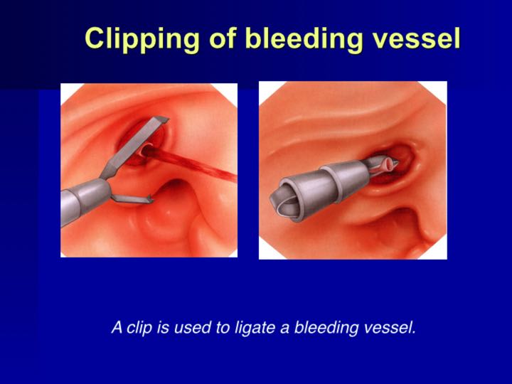 History of Endoscopy endovision