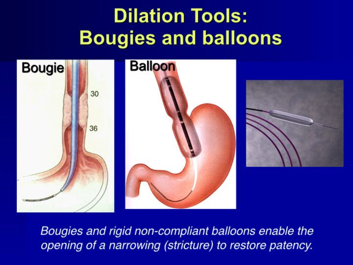 History of Endoscopy endovision