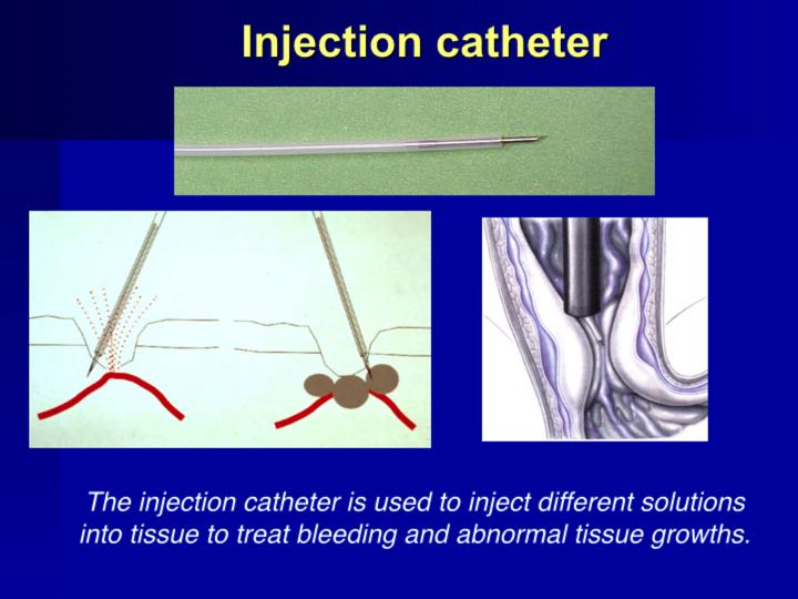 History of Endoscopy endovision