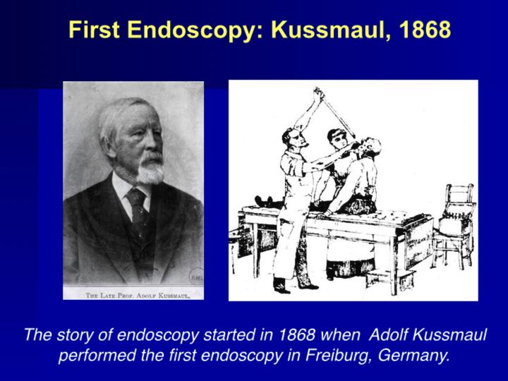 History of Endoscopy endovision