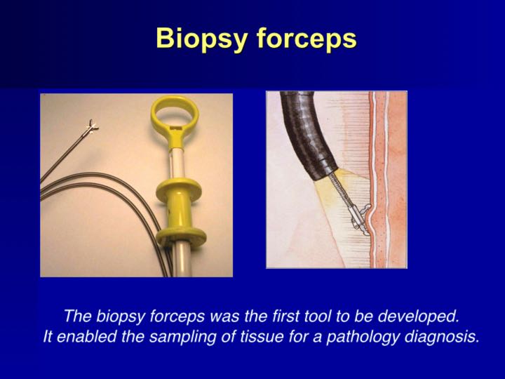 History of Endoscopy endovision