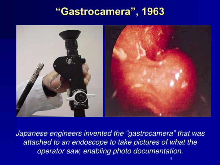 History of Endoscopy endovision