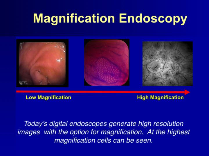 History of Endoscopy endovision