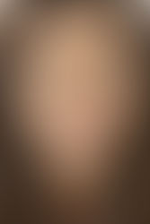 How to Care for Your Braces