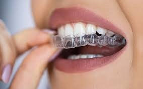 Are Clear Braces Right For Me (Clear Correct or Invisalign®)?