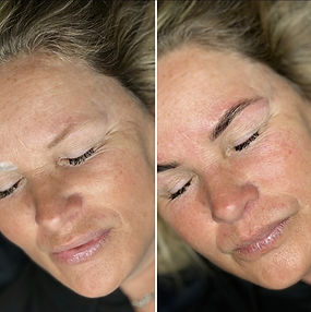 Before-and After - Bryn - 01.JPG