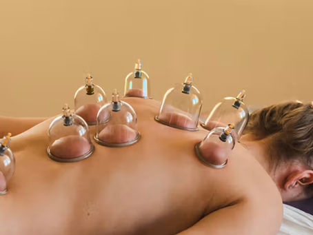 The Ancient Art of Cupping: History, Mechanism, Benefits, and Contraindications