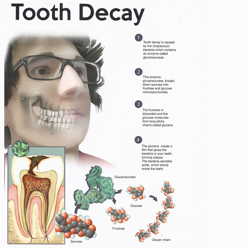 toothdecay8x8