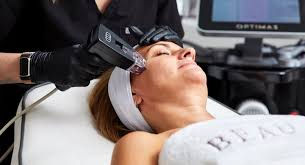 Morpheus8 Full Face (Including Eye Area)