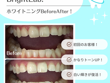 【初回のお客様ビフォーアフター】