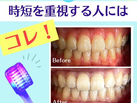 【時短を重視する方にはコレ！】