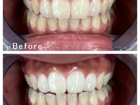 マイナスな影響!?