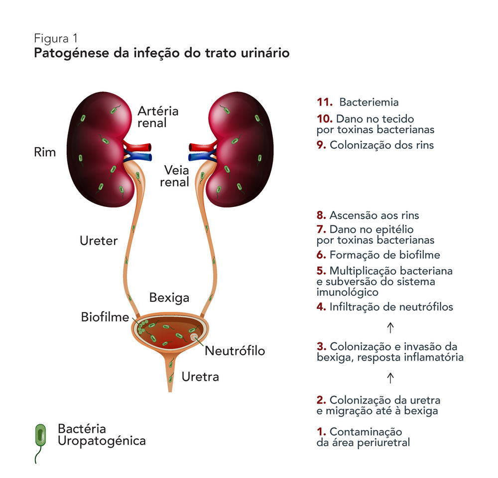 Cid Infecção Do Trato Urinário - RETOEDU