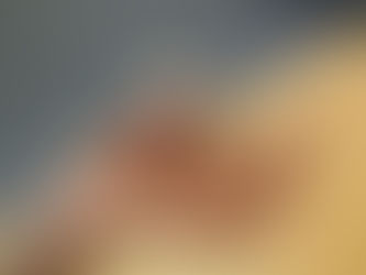 Large study in China backs PD-Monitor for Parkinson’s diagnosis