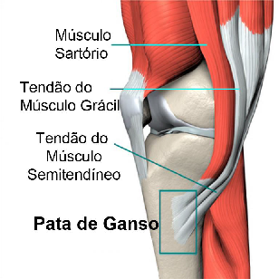Bursite joelho