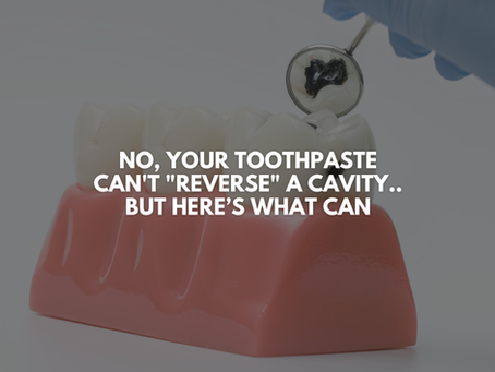 No, Your Toothpaste Can't "Reverse" a Cavity.. But Here’s What Can