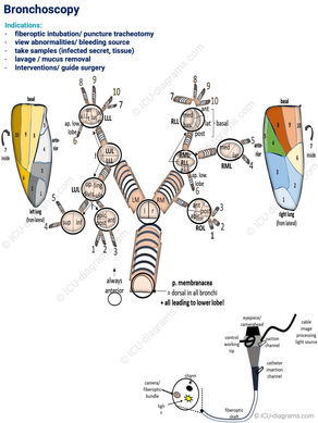 Bronchoscopy / 152-L-PR-10