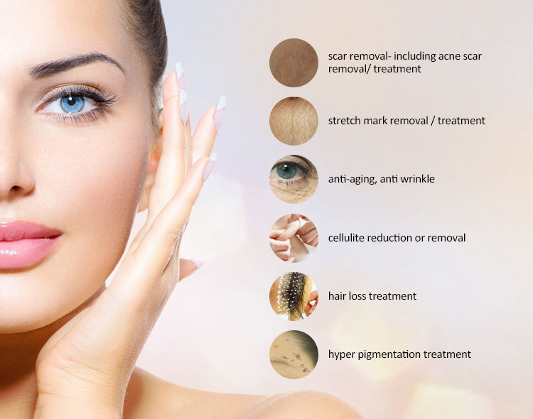 Thumbnail: 5-in-1 Derma Roller Kit for Face and Body