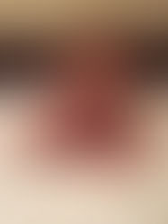 Reporting breastfeeding photos to facebook