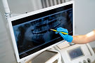 Dentist reviewing jaw x-ray, TMJ diagnosis