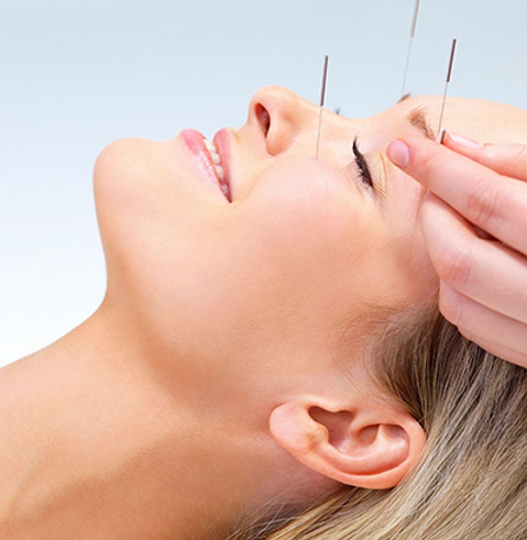 Facial-acupuncture.png
