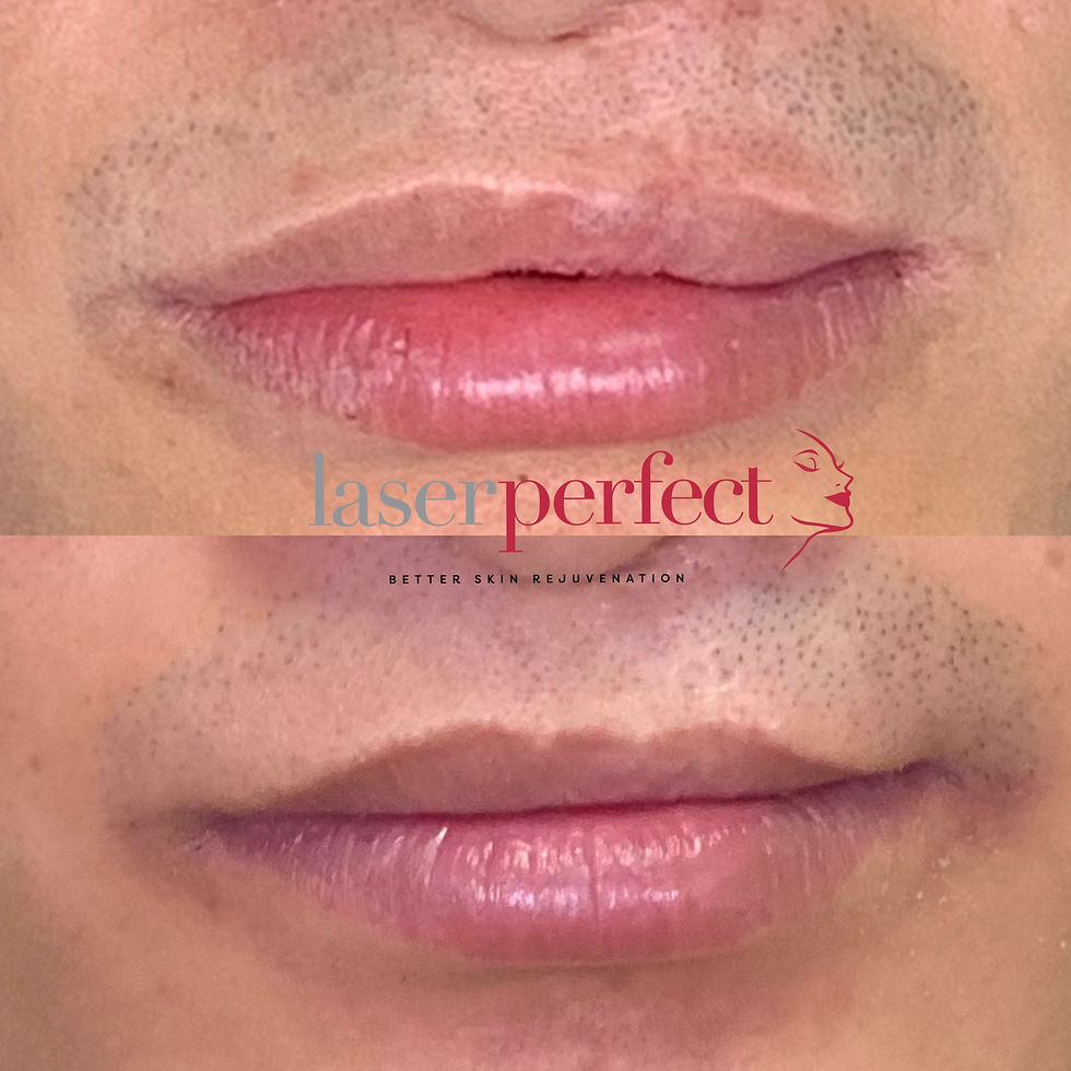Before & After scar reduction