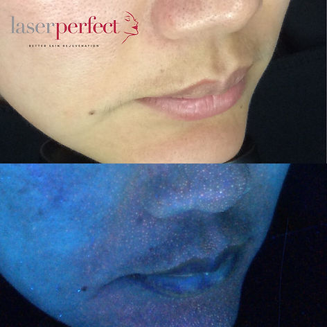observ skin scanning.jpg