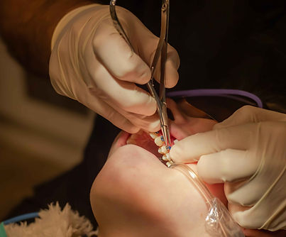orthodontist-put-on-metal-braces-orthodontic-trea-2023-11-27-04-56-49-utc_11zon (1).jpg