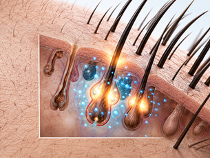 The Science of Regenerative Hair Therapy: How Modern Biostimulation Is Changing Hair Loss Treatment