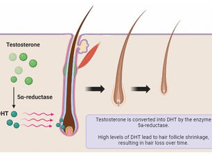 💡 Why DHT Affects Some Hair Follicles and Not Others