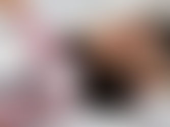 Discover the Benefits of Non-Surgical Hair Restoration