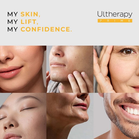 Close-ups of diverse smiling faces showing smooth skin. Text: "MY SKIN, MY LIFT, MY CONFIDENCE." Upper right reads "Ultherapy Prime."