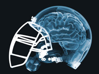 California: Concussions are Up and Football Participation is Down