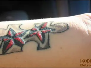 Les Réactions Allergiques aux Encres de Tatouage