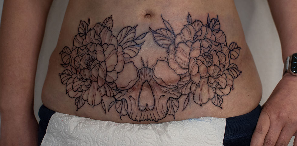Recouvrement de cicatrice - Cicatrice à recouvrir avec un tatouage - Yukari Matcha Tattoo Lausanne