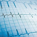 ecg imagem.jpg