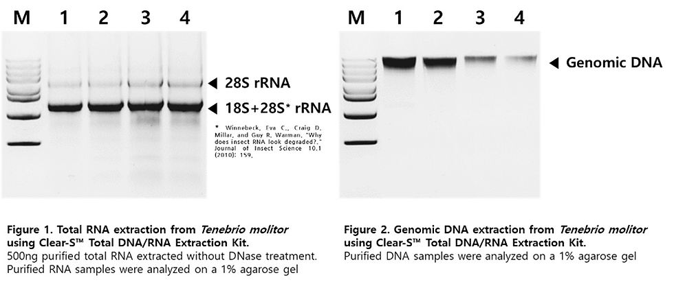 섬네일: Clear-S™ Total DNA/RNA extraction kit, IVT3003, 50rxn