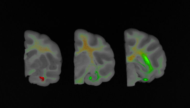 Fluorescence In Vivo Image