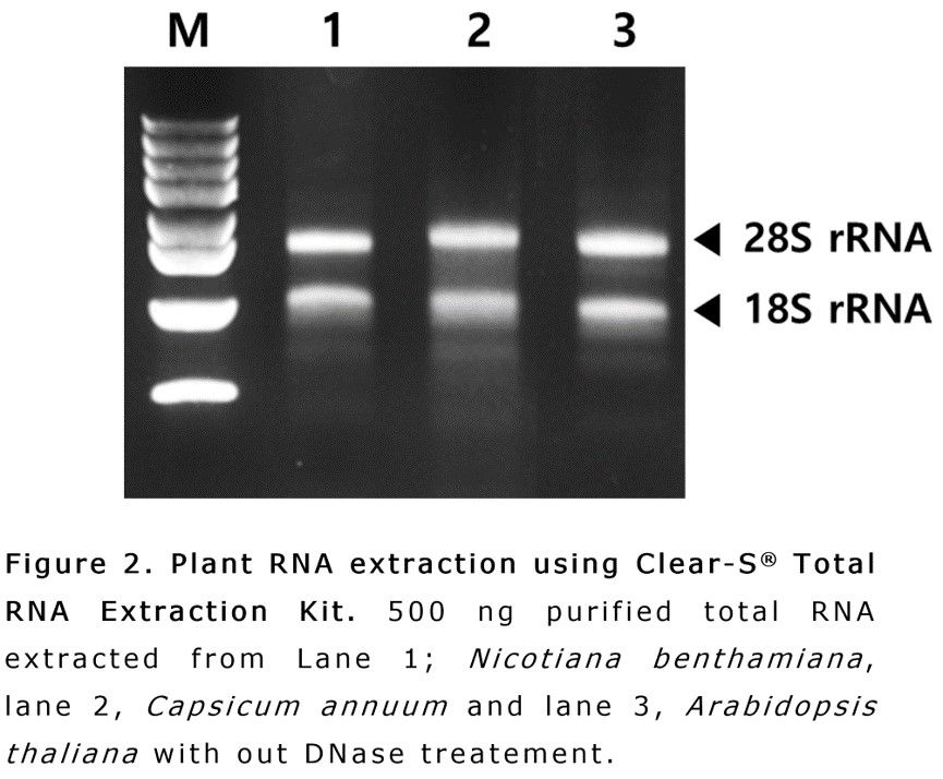 섬네일: Clear-S™ Total RNA Extraction Kit, IVT3001, 50rxn