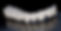 Dental-bridge_1.jpg