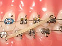 Class3elastics_edited.jpg