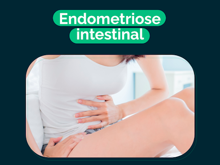 Voce sabe o que é a endometriose Intestinal?