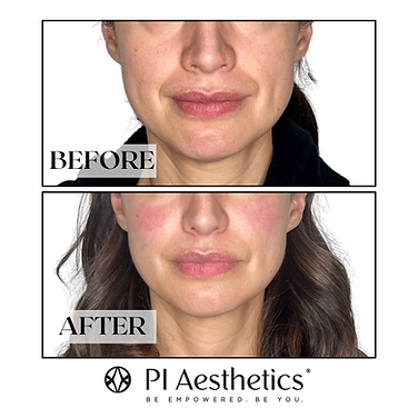 facial balancing 1-1 wBA.png