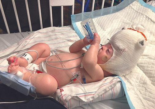 Zane after his first surgery