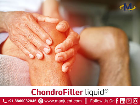 Treating Early Osteoarthritis with ChondroFiller