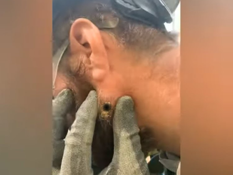 Click Photo below to watch video