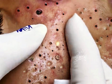 Click Photo below to watch video