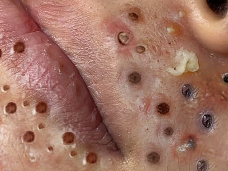 Click Photo below to watch video