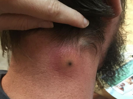 Click Photo below to watch video